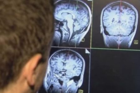 Bilim insanları yarısı alınan beynin kendini yeniden yapılandırdığını keşfetti