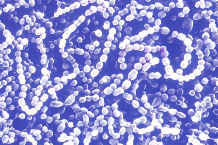 Araştırma: Sepsis hastalığı dünyada her beş ölümden birine neden oluyor