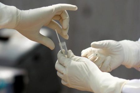 Corona testine ‘acil kullanım’ onayı çıktı!