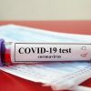 covid19-test