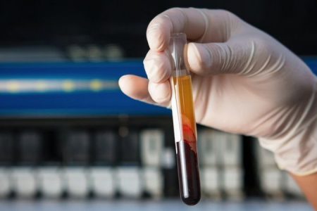 İngiltere’de 50’den fazla kanser türünü erken tespit etmesi umulan kan testi denenecek