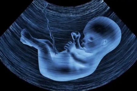 Bebeklerin plasentasında mikroplastik parçacıklar bulundu