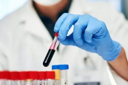 Mikroplastik ilk kez insan kanında tespit edildi