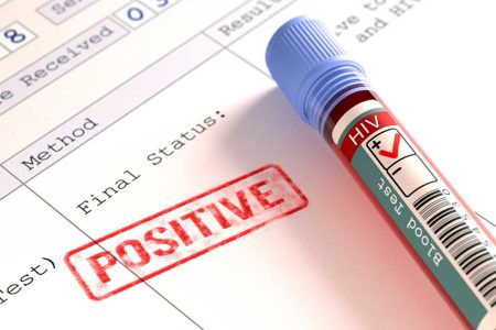 Prof. Dr. Şener: Covid-19’a konsantre olduk ama sessiz bir ‘HIV pandemisi’ var