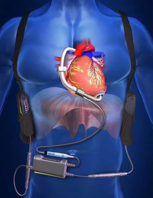 yasam-hakki-erkek-dunyada-yok-sayiliyor2